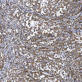 SEMA4F Rabbit Polyclonal Antibody