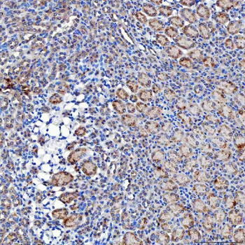 SELENOT Rabbit Polyclonal Antibody