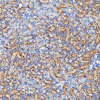 SELENOT Rabbit Polyclonal Antibody