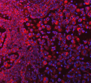 SELENOT Rabbit Polyclonal Antibody