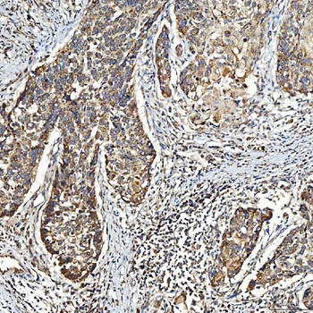SELENOT Rabbit Polyclonal Antibody