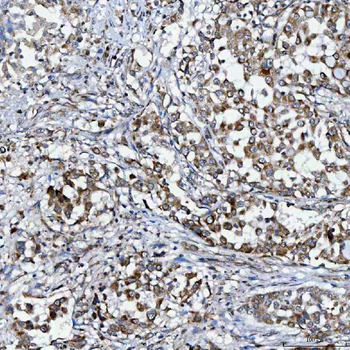 SELENOT Rabbit Polyclonal Antibody