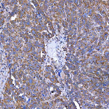 SELENOT Rabbit Polyclonal Antibody