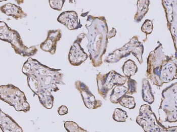 SELENOT Rabbit Polyclonal Antibody