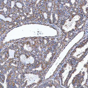 SELENOT Rabbit Polyclonal Antibody