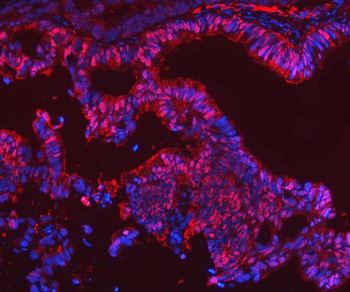 SBP/SELENBP1 Rabbit Polyclonal Antibody
