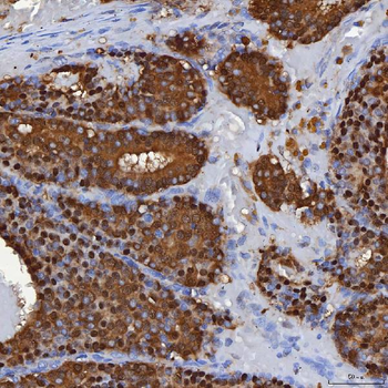 SBP/SELENBP1 Rabbit Polyclonal Antibody