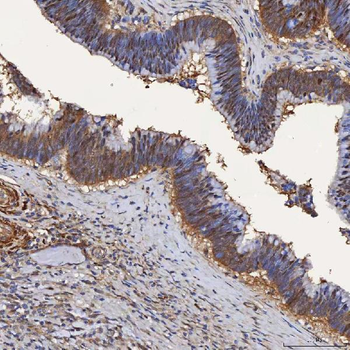 SBP/SELENBP1 Rabbit Polyclonal Antibody
