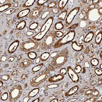 SBP/SELENBP1 Rabbit Polyclonal Antibody