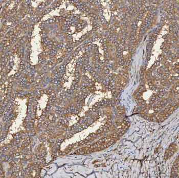 SEC31A Rabbit Polyclonal Antibody