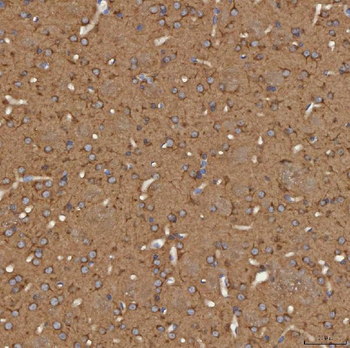 SEC31A Rabbit Polyclonal Antibody