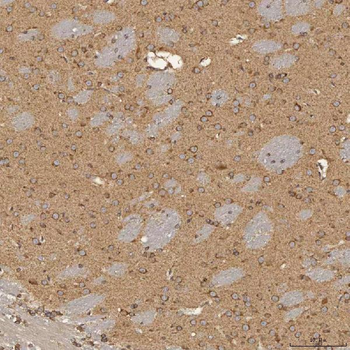 SEC31A Rabbit Polyclonal Antibody