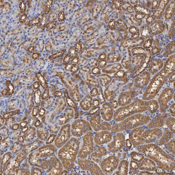 SEC31A Rabbit Polyclonal Antibody