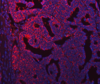 SEC31A Rabbit Polyclonal Antibody