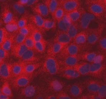 SEC31A Rabbit Polyclonal Antibody