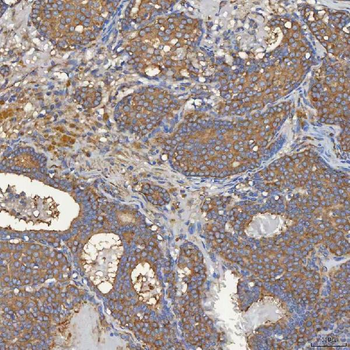 SEC31A Rabbit Polyclonal Antibody