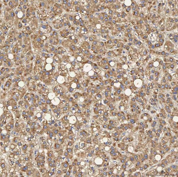 SEC31A Rabbit Polyclonal Antibody