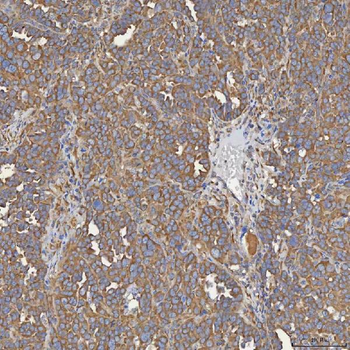 SEC31A Rabbit Polyclonal Antibody