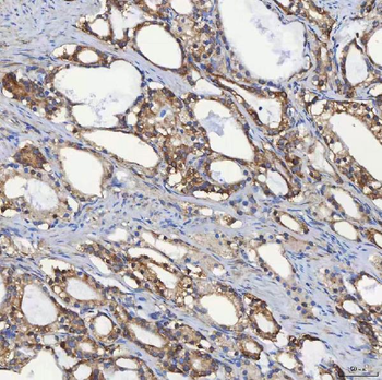 SEC31A Rabbit Polyclonal Antibody