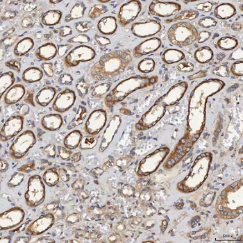 SEC31A Rabbit Polyclonal Antibody