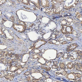 SEC23IP Rabbit Polyclonal Antibody