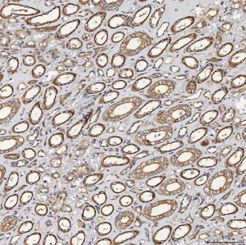 SEC23IP Rabbit Polyclonal Antibody