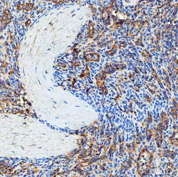 SEC23IP Rabbit Polyclonal Antibody