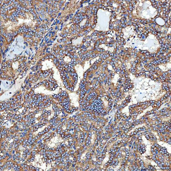SEC23IP Rabbit Polyclonal Antibody
