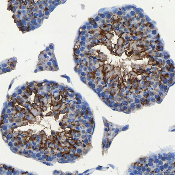 SEC23IP Rabbit Polyclonal Antibody