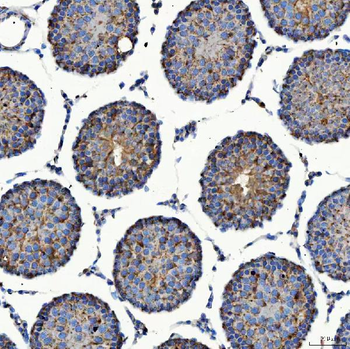 SEC23IP Rabbit Polyclonal Antibody