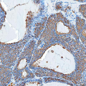 SEC23IP Rabbit Polyclonal Antibody