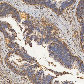 SEC23IP Rabbit Polyclonal Antibody