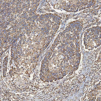 SEC23IP Rabbit Polyclonal Antibody