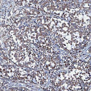 SEC23IP Rabbit Polyclonal Antibody