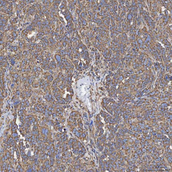 SEC23IP Rabbit Polyclonal Antibody