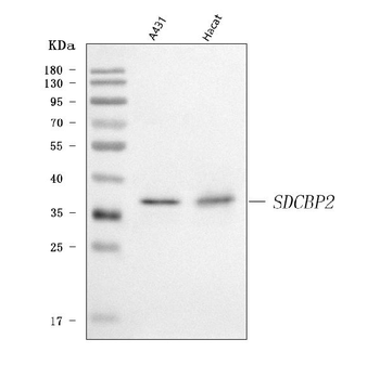 Syntenin 2/SDCBP2 Rabbit Polyclonal Antibody
