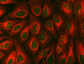 Syntenin 2/SDCBP2 Rabbit Polyclonal Antibody