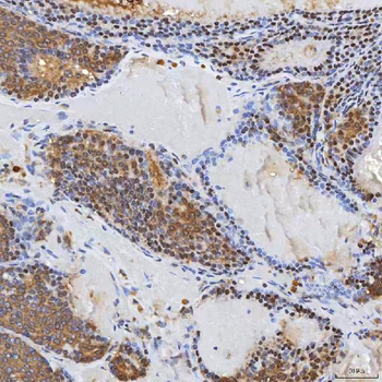 Syntenin 2/SDCBP2 Rabbit Polyclonal Antibody