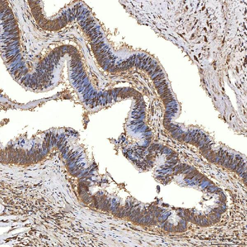 Syntenin 2/SDCBP2 Rabbit Polyclonal Antibody