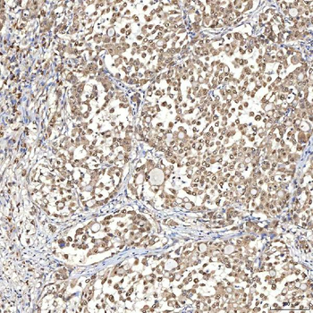 Syntenin 2/SDCBP2 Rabbit Polyclonal Antibody