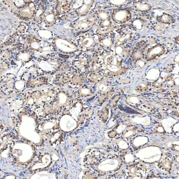 Syntenin 2/SDCBP2 Rabbit Polyclonal Antibody
