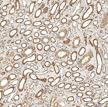 Syntenin 2/SDCBP2 Rabbit Polyclonal Antibody