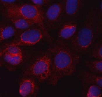 eNOS/NOS3 Rabbit Polyclonal Antibody