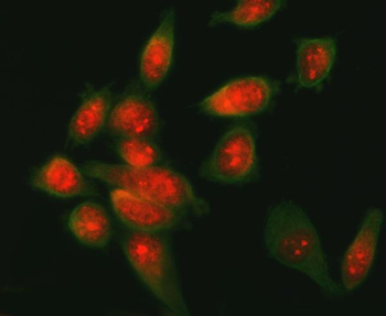 ATF6 Rabbit Polyclonal Antibody