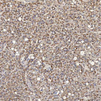 ACAD9 Rabbit Polyclonal Antibody