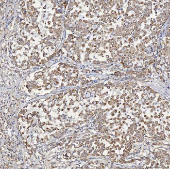 ACAD9 Rabbit Polyclonal Antibody