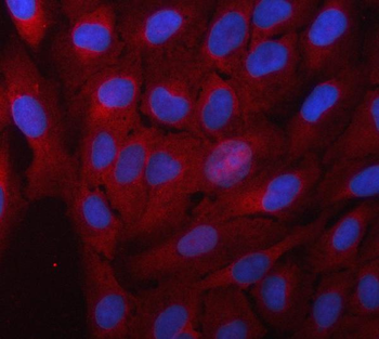 Alpha Taxilin/TXLNA Rabbit Polyclonal Antibody