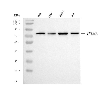 Alpha Taxilin/TXLNA Rabbit Polyclonal Antibody