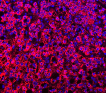 TTLL2 Rabbit Polyclonal Antibody