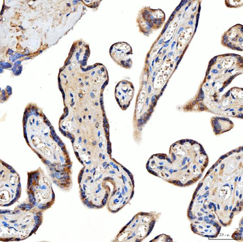 TTLL2 Rabbit Polyclonal Antibody